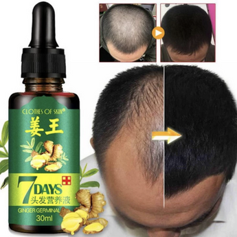 Hair Regrowth Serum - For Men & Women